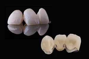 ポーセレン陶材